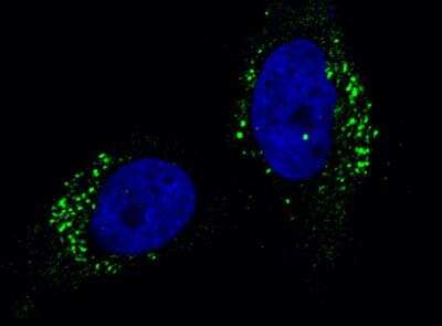 Immunocytochemistry/Immunofluorescence: Cathepsin A/Lysosomal Carboxypeptidase A Antibody (104) [NBP2-89526] - Staining of Human CTSA in Hela cells. Cells were fixed with 4% PFA, permeabilzed with 0.3% Triton X-100 in PBS, blocked with 10% serum, and incubated with rabbit anti-Human CTSA monoclonal antibody (1:60) at 4c overnight. Then cells were stained with the Alexa Fluor(R) 488-conjugated Goat Anti-rabbit IgG secondary antibody (green) and counterstained with DAPI (blue). Positive staining was localized to cytoplasm.
