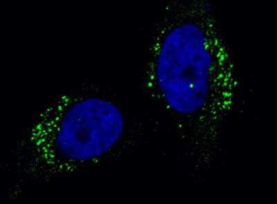 Immunocytochemistry/Immunofluorescence: Cathepsin A/Lysosomal Carboxypeptidase A Antibody (104) [NBP2-89526] - Staining of Human CTSA in Hela cells. Cells were fixed with 4% PFA, permeabilzed with 0.3% Triton X-100 in PBS, blocked with 10% serum, and incubated with rabbit anti-Human CTSA monoclonal antibody (1:60) at 4c overnight. Then cells were stained with the Alexa Fluor(R) 488-conjugated Goat Anti-rabbit IgG secondary antibody (green) and counterstained with DAPI (blue). Positive staining was localized to cytoplasm.