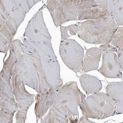 Immunohistochemistry-Paraffin: Cathepsin A/Lysosomal Carboxypeptidase A Antibody [NBP1-89728] - Staining of human skeletal muscle shows only very weak positivity in striated muscle fibers as expected.