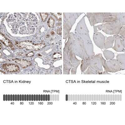 <b>Orthogonal Strategies Validation. </b>Immunohistochemistry-Paraffin: Cathepsin A/Lysosomal Carboxypeptidase A Antibody [NBP1-89728] - Staining in human kidney and skeletal muscle tissues . Corresponding CTSA RNA-seq data are presented for the same tissues.