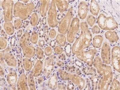 Immunohistochemistry-Paraffin: Cathepsin A/Lysosomal Carboxypeptidase A Antibody [NBP2-98190] - Staining of human Cathepsin A/Lysosomal Carboxypeptidase A in human kidney with rabbit polyclonal antibody at 1:100 dilution.