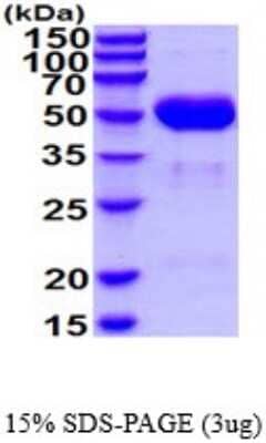 SDS-Page: Recombinant Mouse Cathepsin A/Lysosomal Carboxypeptidase A Protein [NBP2-52322] - 15% SDS Page (3 ug)