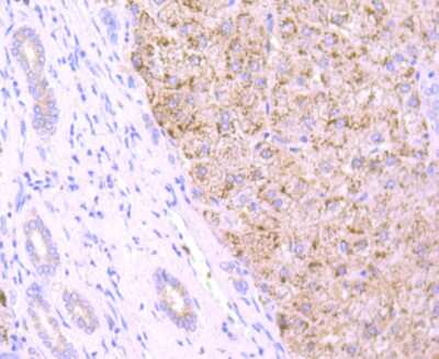 Immunohistochemistry-Paraffin: Cathepsin B Antibody (JA11-02) [NBP2-67215] - Analysis of paraffin-embedded human liver tissue using anti-Cathepsin B antibody. Counter stained with hematoxylin.
