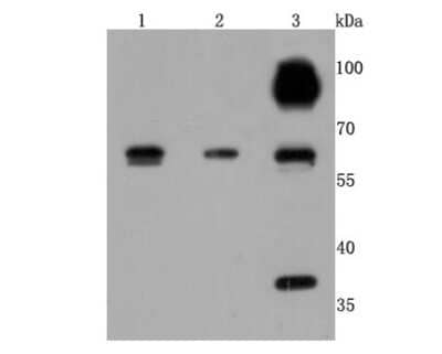 Western Blot: Cathepsin B Antibody (JA11-02) [NBP2-67215] - Analysis of Cathepsin B on different cells lysates using anti-Cathepsin B antibody at 1/500 dilution. Positive control: Line 1: HepG2 Line 2: Hela Line 3:A549