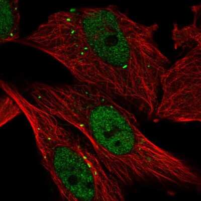 Immunocytochemistry/Immunofluorescence: Cathepsin C/DPPI Antibody [NBP2-57844] - Staining of human cell line U-2 OS shows localization to nucleoplasm & vesicles.