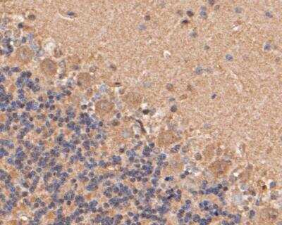 Immunohistochemistry-Paraffin: Cathepsin D Antibody (13F2) [NBP2-89156] - Analysis of paraffin-embedded rat cerebellum tissue using anti-Cathepsin D antibody. The section was pre-treated using heat mediated antigen retrieval with Tris-EDTA buffer (pH 8.0-8.4) for 20 minutes.The tissues were blocked in 5% BSA for 30 minutes at room temperature, washed with ddH2O and PBS, and then probed with the primary antibody( 1/50) for 30 minutes at room temperature. The detection was performed using an HRP conjugated compact polymer system. DAB was used as the chromogen. Tissues were counterstained with hematoxylin and mounted with DPX.
