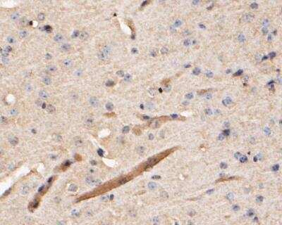 Immunohistochemistry-Paraffin: Cathepsin D Antibody (13F2) [NBP2-89156] - Analysis of paraffin-embedded human liver tissue using anti-Cathepsin D antibody. The section was pre-treated using heat mediated antigen retrieval with Tris-EDTA buffer (pH 8.0-8.4) for 20 minutes.The tissues were blocked in 5% BSA for 30 minutes at room temperature, washed with ddH2O and PBS, and then probed with the primary antibody( 1/50) for 30 minutes at room temperature. The detection was performed using an HRP conjugated compact polymer system. DAB was used as the chromogen. Tissues were counterstained with hematoxylin and mounted with DPX.