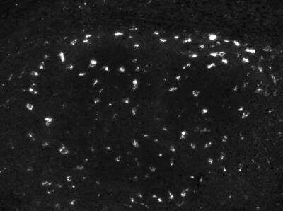 Immunohistochemistry-Paraffin: Cathepsin D Antibody (4G2) [NBP1-04278] - Cathepsin D 1:50 on tonsil, pH 9 antigen retrieval. IHC-P image submitted by a verified customer review. 