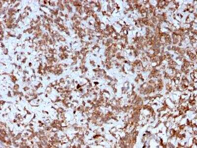 Immunohistochemistry-Paraffin: Cathepsin K Antibody (CTSK/2792) - Azide and BSA Free [NBP2-79890] - Formalin-fixed, paraffin-embedded human Liver stained with Cathepsin K Mouse Monoclonal Antibody (CTSK/2792).