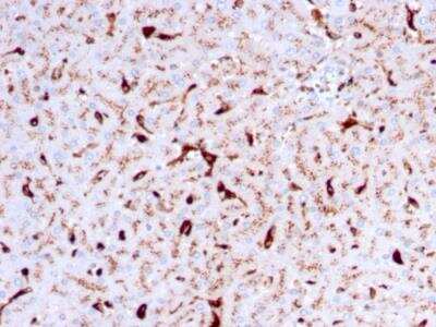 Immunohistochemistry-Paraffin: Cathepsin K Antibody (CTSK/2792) - Azide and BSA Free [NBP2-79890] - Formalin-fixed, paraffin-embedded human Liver stained with Cathepsin K Mouse Monoclonal Antibody (CTSK/2792).