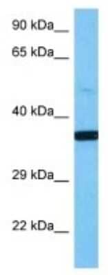Western Blot: Cathepsin L1 Antibody [NBP3-10283] - Western blot analysis of Cathepsin L1 in Mouse Stomach lysates. Antibody dilution at 1ug/ml
