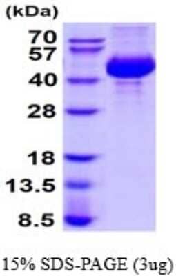 SDS-Page: Recombinant Mouse Cathepsin L1 Protein [NBP2-52318] - 15% SDS Page (3 ug)