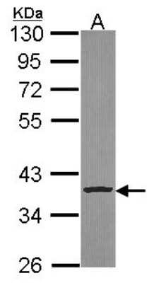 Western Blot: Cathepsin S Antibody [NBP2-15727] - Sample (30 ug of whole cell lysate) A: Hela 10% SDS PAGE gel, diluted at 1:1000.