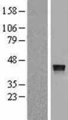 Western Blot: Cathepsin V Overexpression Lysate (Adult Normal) [NBL1-09596] Left-Empty vector transfected control cell lysate (HEK293 cell lysate); Right -Over-expression Lysate for Cathepsin V.