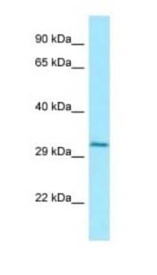 Western Blot: Cathepsin W Antibody [NBP1-98601] - Titration: 1.0 ug/ml Positive Control: HepG2 Whole Cell.