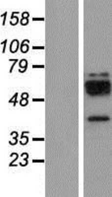 Western Blot: Cathepsin W Overexpression Lysate (Adult Normal) [NBP2-10971] Left-Empty vector transfected control cell lysate (HEK293 cell lysate); Right -Over-expression Lysate for Cathepsin W.