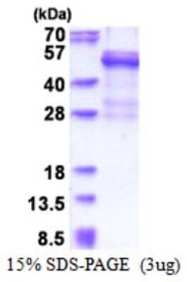 SDS-Page: Recombinant Human Cathepsin W Protein [NBP2-51517] - 15% SDS Page (3 ug)