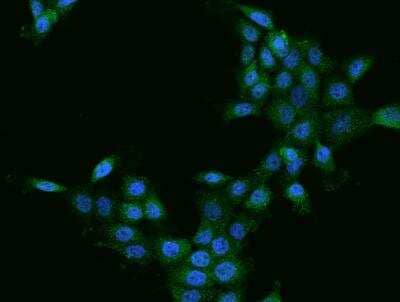 Immunocytochemistry/Immunofluorescence: Cathepsin Z Antibody [NBP3-06499] - Staining of CTSZ in A431 cells. Cells were fixed with 4% PFA, permeabilzed with 0.1% Triton X-100 in PBS,blocked with 10% serum, and incubated with rabbit anti-Human CTSZ polyclonal antibody (dilution ratio 1:200) at 4? overnight. Then cells were stained with the Alexa Fluor®488-conjugated Goat Anti-rabbit IgG secondary antibody (green) and counterstained with DAPI (blue).Positive staining was localized to Cytoplasm.