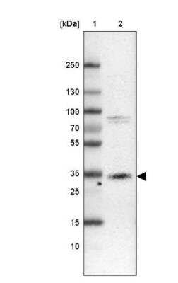 Western Blot: Cathepsin X/Z/P Antibody [NBP2-38614] -  Lane 1: Marker [kDa] 250, 130, 100, 70, 55, 35, 25, 15, 10Lane 2: Human cell line CACO-2