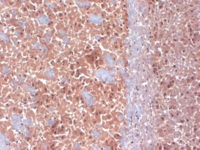 Immunohistochemistry-Frozen: Cav1.3 Antibody (S38-8) [NBP2-12894] - Tissue: frozen brain section. Species: mouse. Fixation: 10% Formalin Solution for 12-24 hours at RT. Primary Antibody: Mouse Anti-CaV1.3 Calcium channel Monoclonal Antibody at 1:1000 for 1 hour at RT. Secondary Antibody: HRP/DAB Detection System: Biotinylated Goat Anti-Mouse, Streptavidin Peroxidase, DAB Chromogen (brown) for 30 minutes at RT. Counterstain: Mayer Hematoxylin (purple/blue) nuclear stain at 250-500 ul for 5 minutes at RT.