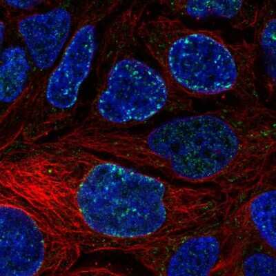 Immunocytochemistry/Immunofluorescence: Cav1.3 Antibody [NBP1-86684] - Staining of human cell line CACO-2 shows localization to nuclear membrane. Antibody staining is shown in green. 