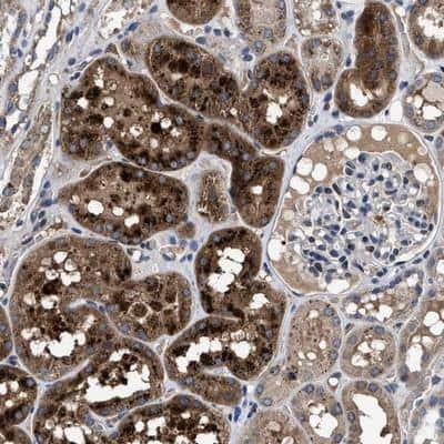 Immunohistochemistry-Paraffin: Cav1.3 Antibody [NBP1-86684] - Staining of human kidney shows strong cytoplasmic positivity in cells in tubules.