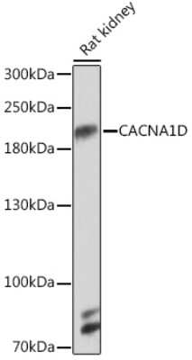 Western Blot: Cav1.3 Antibody [NBP3-15489] - Western blot analysis of extracts of Rat kidney, using Cav1.3 Rabbit pAb (NBP3-15489) at 1:1000 dilution. Secondary antibody: HRP Goat Anti-Rabbit IgG (H+L) at 1:10000 dilution. Lysates/proteins: 25ug per lane. Blocking buffer: 3% nonfat dry milk in TBST. Detection: ECL Basic Kit. Exposure time: 90s.