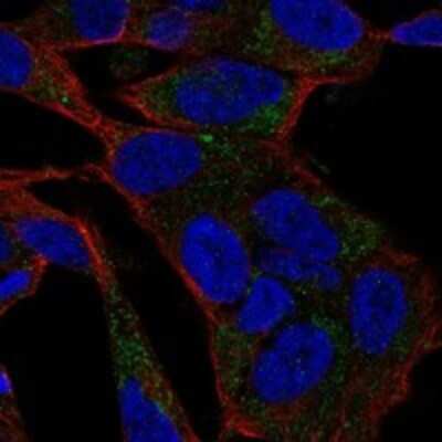 Immunocytochemistry/Immunofluorescence: Cav2.2 Antibody [NBP3-17353] - Staining of human cell line SH-SY5Y shows localization to mitochondria.