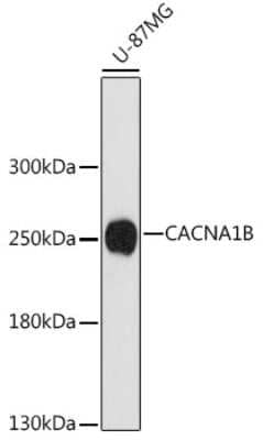 Western Blot: Cav2.2 Antibody [NBP2-92336] - Analysis of extracts of U-87MG cells, using Cav2.2 at 1:1000 dilution.Secondary antibody: HRP Goat Anti-Rabbit IgG (H+L) at 1:10000 dilution.Lysates/proteins: 25ug per lane.Blocking buffer: 3% nonfat dry milk in TBST.Detection: ECL Basic Kit .Exposure time: 3min.