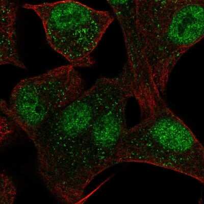 Immunocytochemistry/Immunofluorescence: Cav3.2 Antibody [NBP1-88176] - Staining of human cell line A549 shows localization to nucleoplasm & vesicles.