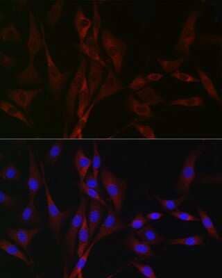 Immunocytochemistry/Immunofluorescence: Cav3.2 Antibody [NBP3-15334] - Immunofluorescence analysis of NIH/3T3 cells using Cav3.2 Rabbit pAb (NBP3-15334) at dilution of 1:100 (40x lens). Blue: DAPI for nuclear staining.