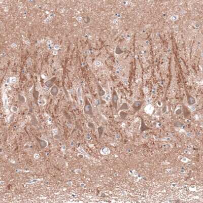 Immunohistochemistry-Paraffin: Cav3.2 Antibody [NBP1-88176] - Staining of human hippocampus shows moderate membranous positivity in CA1 neurons.