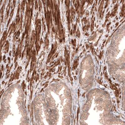 Immunohistochemistry-Paraffin: Cav3.2 Antibody [NBP1-88176] - Staining of human prostate shows moderate to strong membranous and cytoplasmic positivity in smooth muscle cells.