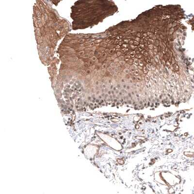 Immunohistochemistry-Paraffin: Cav3.2 Antibody [NBP1-88176] - Staining of human urothelium shows moderate to strong membranous positivity in squamous epithelial cells.