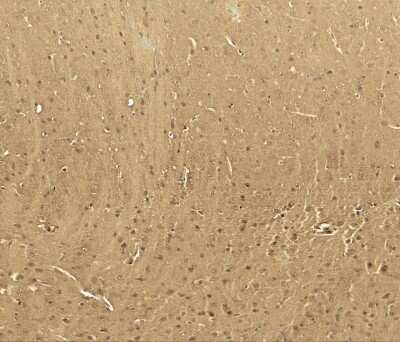 Immunohistochemistry-Paraffin: Cav3.2 Antibody [NBP2-41303] - Cav3.2 in mouse brain tissue withCav3.2 antibody at 5 ug/ml.