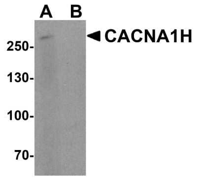 Western Blot: Cav3.2 Antibody [NBP2-41303] - Analysis of CACNA1H in 293 cell lysate with CACNA1H antibody at 1 ug/ml in (A) the absence and (B) the presence of blocking peptide.