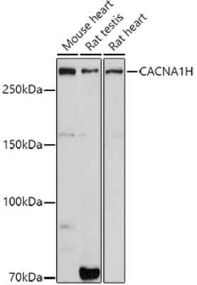 Western Blot: Cav3.2 Antibody [NBP3-15334] - Western blot analysis of extracts of various cell lines, using Cav3.2 antibody (NBP3-15334) at 1:1000 dilution. Secondary antibody: HRP Goat Anti-Rabbit IgG (H+L) at 1:10000 dilution. Lysates/proteins: 25ug per lane. Blocking buffer: 3% nonfat dry milk in TBST. Detection: ECL Basic Kit. Exposure time: 180s.