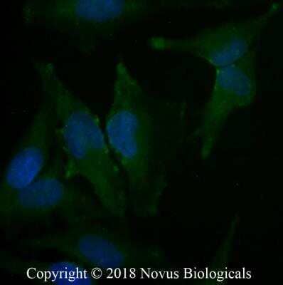 Immunocytochemistry/Immunofluorescence: Caveolin-1 Antibody (7C8) [Alexa Fluor® 488] [NB100-615AF488] - HeLa cells were fixed for 10 minutes using 10% formalin and then permeabilized for 5 minutes using 1X PBS + 0.05% Triton-X100.  The cells were incubated with anti-Caveolin-1 [7C8] conjugated to Alexa Fluor 488 [NB100-615AF488] at 20 ug/ml for 1 hour at room temperature.  Nuclei were counterstained with DAPI (Blue).  Cells were imaged using a 40X objective.