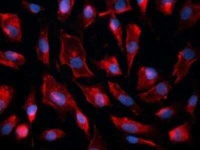 Immunocytochemistry/Immunofluorescence: Caveolin-1 Antibody (7C8) - Azide and BSA Free [NBP2-80617] - Antibody at 1:200 dilution (ON incubation) on EaHy926 endothelial cell line showing a clear localization in lipid raft/membrane. Photo courtesy of Alberto Davalos, Yale School of Medicine. Image from the standard format of this antibody.