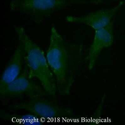 Immunocytochemistry/Immunofluorescence: Caveolin-1 Antibody (7C8) - Azide and BSA Free [NBP2-80617] - HeLa cells were fixed for 10 minutes using 10% formalin and then permeabilized for 5 minutes using 1X PBS + 0.05% Triton X-100. The cells were incubated with anti-Caveolin-1 [7C8] conjugated to Alexa Fluor 488 (NB100-615AF488) at 20 ug/mL for 1 hour at room temperature. Nuclei were counterstained with DAPI (Blue). Cells were imaged using a 40X objective. Image from the standard format of this antibody.