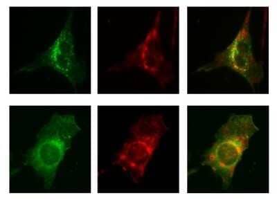 Immunocytochemistry/Immunofluorescence: Caveolin-1 Antibody (7C8) - Azide and BSA Free [NBP2-80617] - Subcellular localization of mPARM-1 and hPARM-1 (full-length and mutant proteins). NIH/3T3 cells transiently expressing hPARM-1-GFP or deltaCT-GFP were fixed, immunostained for caveolin-1 (1:100, Novus Biologicals), and examined by confocal fluorescence microscopy. For hPARM-1-GFP-caveolin-1 co-localization, cells that demonstrated cell membrane PARM-1 localization were chosen. All co-localizations were observed following merging images of GFP-tagged proteins with those of Golgi, endosomes, plasma membrane, alpha-tubulin or caveolin-1 labeling. Image collected and cropped by CiteAb from the following publication (//molecular-cancer.biomedcentral.com/articles/10.1186/1476-4598-12-84), licensed under a CC-BY license. Image from the standard format of this antibody.