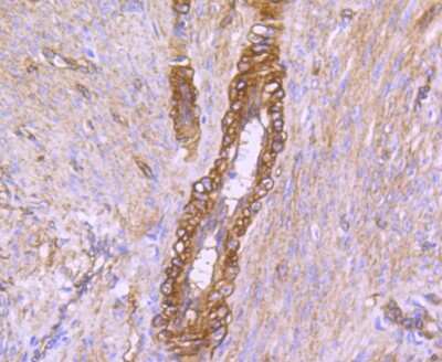 Immunohistochemistry-Paraffin: Caveolin-2 Antibody (SY22-05) [NBP2-67423] - Immunohistochemical analysis of paraffin-embedded human uterus tissue using anti-caveolin-2 antibody. Counter stained with hematoxylin.