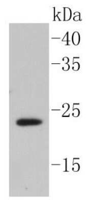 Western Blot: Caveolin-2 Antibody (SY22-05) [NBP2-67423] - Analysis of caveolin-2 on HUVEC cell lysates using anti-caveolin-2 antibody at 1/1,000 dilution.