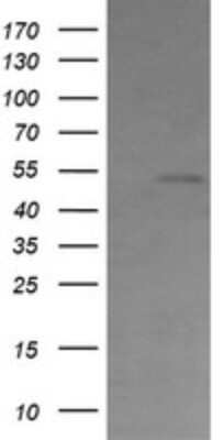 Western Blot Cbl-c Antibody (OTI3B4) - Azide and BSA Free