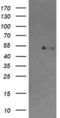 Western Blot: Cbl-c Antibody (OTI4E3) - Azide and BSA Free [NBP2-71756] - Analysis of HEK293T cells were transfected with the pCMV6-ENTRY control (Left lane) or pCMV6-ENTRY CBL-C.