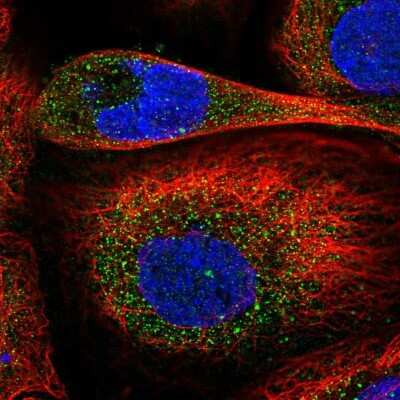 Immunocytochemistry/Immunofluorescence: Ccd1/DIXDC1 Antibody [NBP2-58141] - Staining of human cell line A-431 shows localization to cytosol.