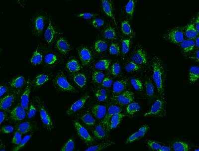 Immunocytochemistry/Immunofluorescence: Ccd1/DIXDC1 Antibody [NBP3-12691] -  Staining of DIXDC1 in U2OS cells. Cells were fixed with 4% PFA, permeabilzed with 0.3% Triton X-100 in PBS,blocked with 10% serum, and incubated with rabbit anti-Human DIXDC1 polyclonal antibody (dilution ratio 1:200) at 4? overnight. Then cells were stained with the Alexa Fluor®488-conjugated Goat Anti-rabbit IgG secondary antibody (green) and counterstained with DAPI (blue).Positive staining was localized to Cytoplasm.