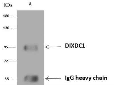 Immunoprecipitation: Ccd1/DIXDC1 Antibody [NBP3-12691] - Lane A:0.5 mg HeLa Whole Cell Lysate4 uL anti-DIXDC1 rabbit polyclonal antibody and 60 ug of Immunomagnetic beads Protein A/G.Primary antibody:Anti-DIXDC1 rabbit polyclonal antibody,at 1:100 dilution Secondary antibody:Goat Anti-Rabbit IgG (H+L)/HRP at 1/10000 dilutionDeveloped using the ECL technique.Performed under reducing conditions.Predicted band size: 77 kDaObserved band size :95 kDa