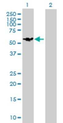 Western Blot: Ccd1/DIXDC1 Antibody [H00085458-B01P] - Analysis of DIXDC1 expression in transfected 293T cell line by DIXDC1 polyclonal antibody.  Lane 1: DIXDC1 transfected lysate(51.92 KDa). Lane 2: Non-transfected lysate.