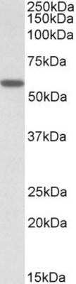 Western Blot: Ccd1/DIXDC1 Antibody [NBP1-46147] - NBP1-46147 (0.5ug/ml) staining of Human Skeletal Muscle lysate (35ug protein in RIPA buffer). Primary incubation was 1 hour. Detected by chemiluminescence.